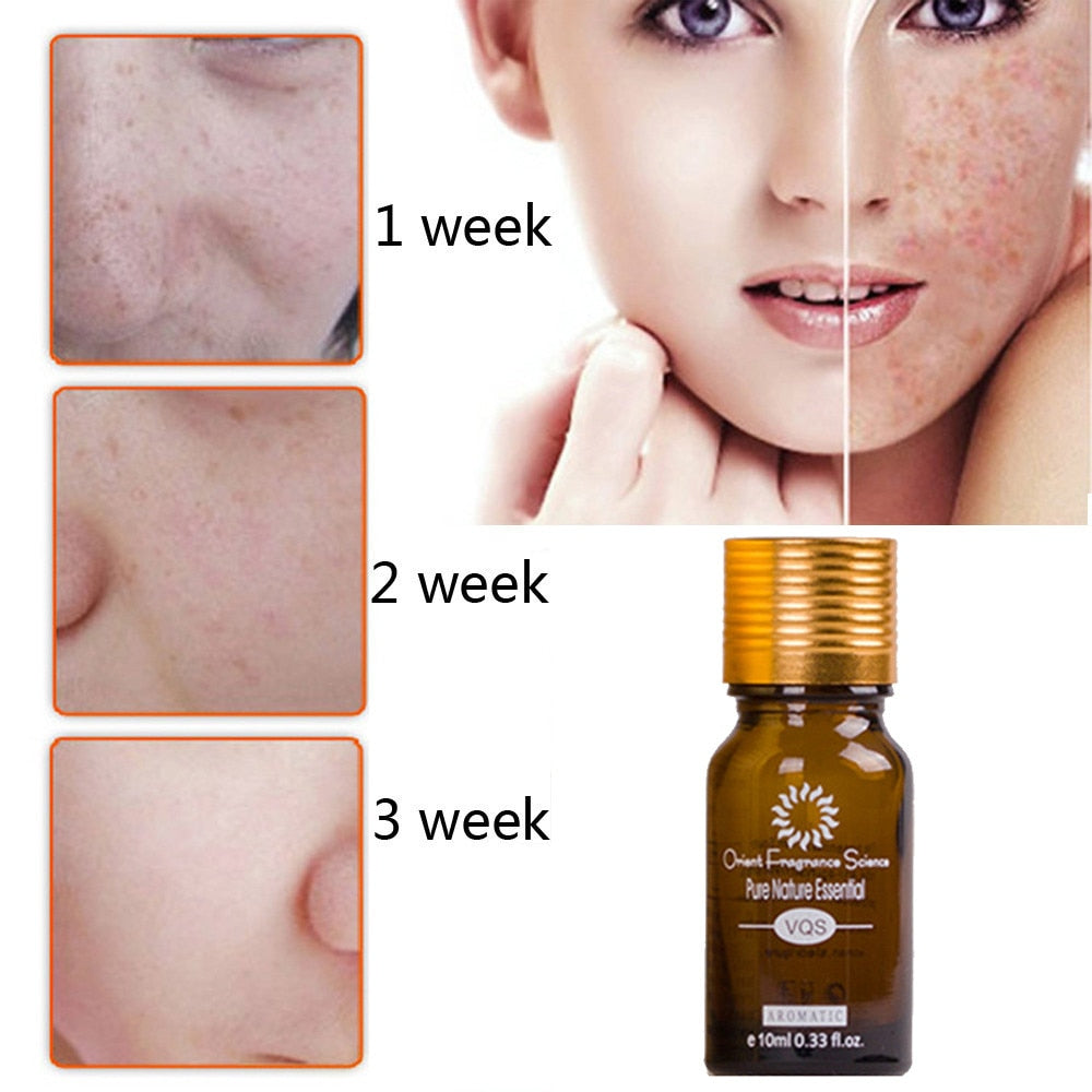 Dredge Meridian Skin Care Natural Pure Removal Acne Stretch Marks Scar Removal Essence oil زيت دريدج ميريديان للعناية بالبشرة، طبيعي ونقي، لإزالة حب الشباب وعلامات التمدد والندبات